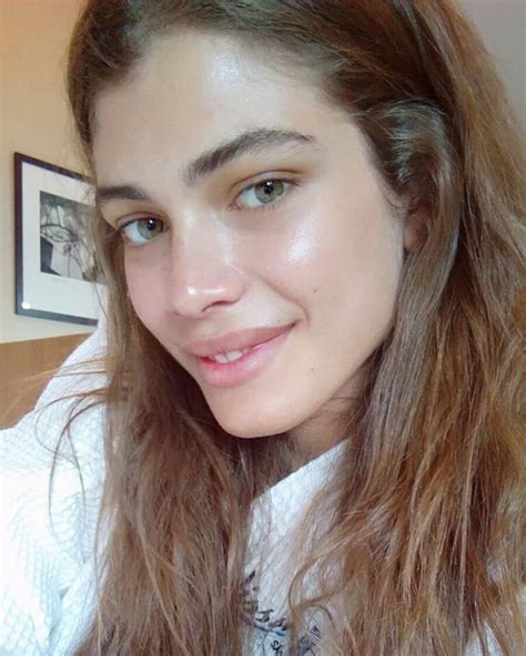 valentina sampaio before surgery photos.